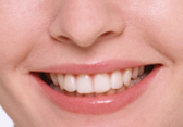 esthetic_images_02 esthetic_images_02
